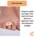 Sử dụng miếng dán corn không an toàn theo lời khuyên của chuyên gia